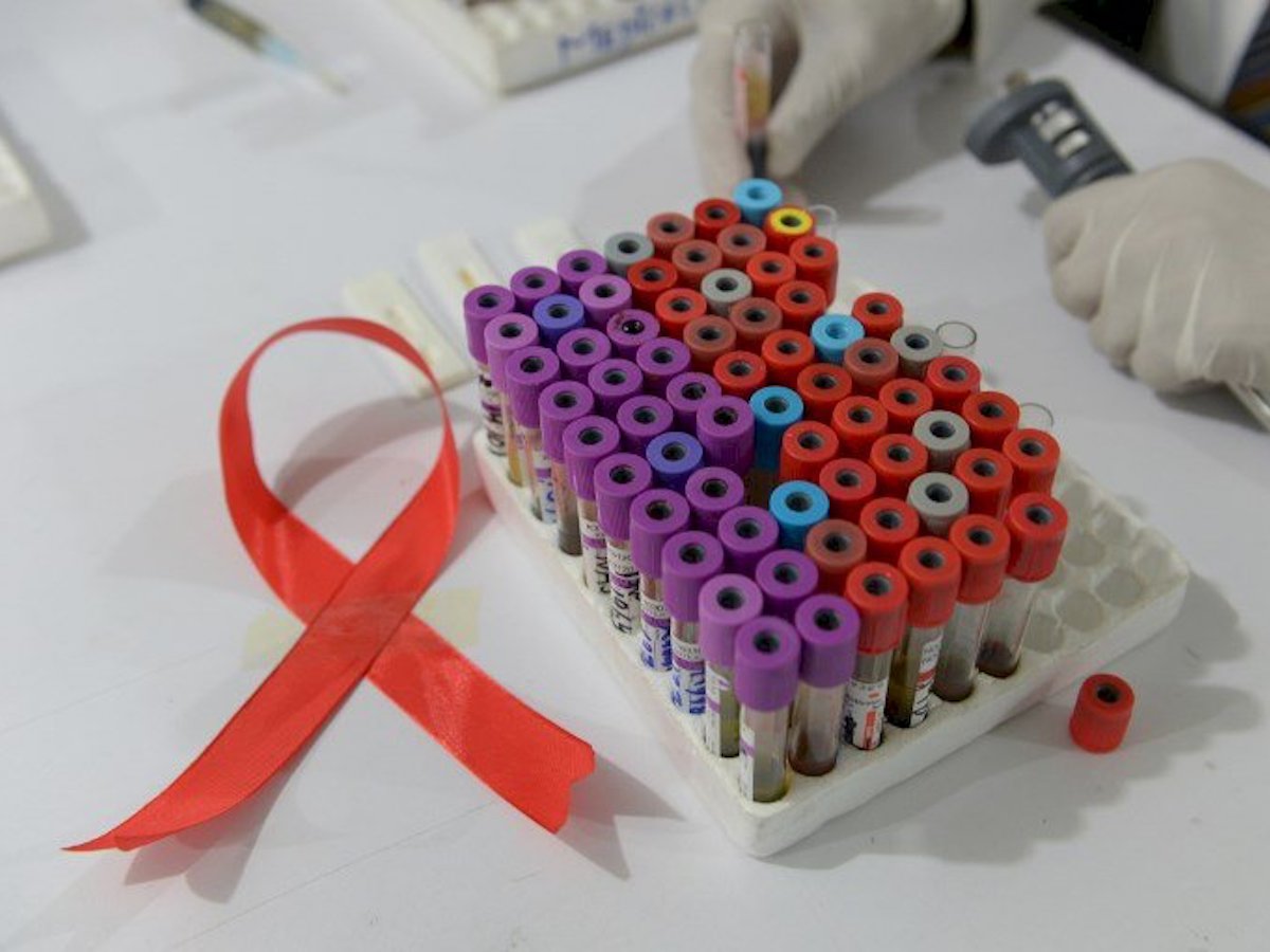 愛滋病滿40週年 COVID-19疫情帶來阻力與轉機